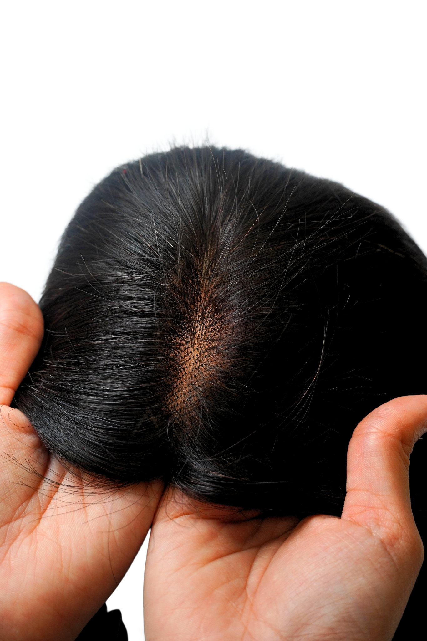 FULL HEAD LACE PATCH